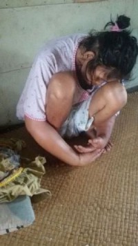 Keluarga Miskin di Dusun Keramat Menderita Penyakit Kanker Butuh Bantuan Pemerintah dan Masyarakat