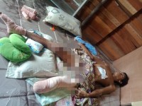 Kapolsek Tambang Bantu Warga Desa Kualu Korban Kecelakaan Dengan Kondisi Memprihatinkan