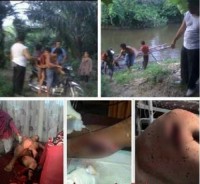 Bisa Jadi Karena  Dendam Lama, Dua Pemuda Batang Gansal Saling Bacok