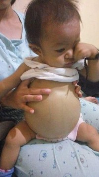 Bocah di Inhil ini Butuh Bantuan, Alami Penyakit yang Mengerikan