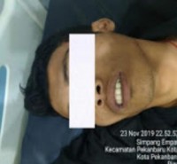 Polda Riau Dan Sat Reskrim Polresta Pekanbaru Ungkap Kasus Curat Modus Pecah Kaca Mobil