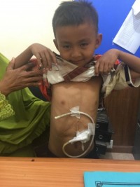 Pemkab Rohul Bantu Penderita Tumor Hati Berobat ke RSCM Jakarta
